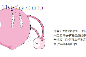 头胎若是剖宫产 二胎注意什么？